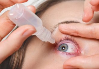 Cataract
