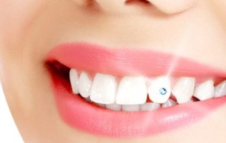 Tooth Jewellery