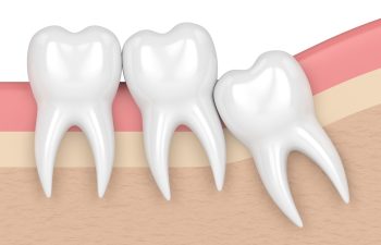 Eye and dental hospital in aurangabad-chintamani hospital